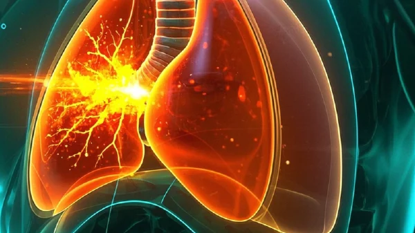 全面解析支气管炎与合并症的科学管理