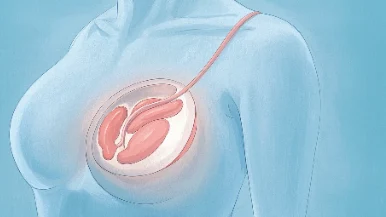 乳腺癌预防与早期信号:女性健康指南