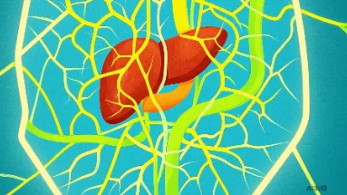 胆囊炎手术麻醉：确保安全与效果的关键