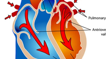 冠心病与高脂血症的综合管理：从诊断到治疗