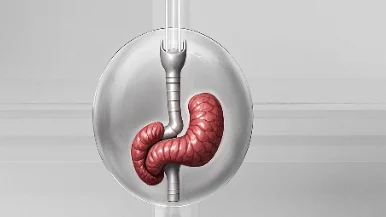 食管癌三期的治疗新视野:预后与生存率探析