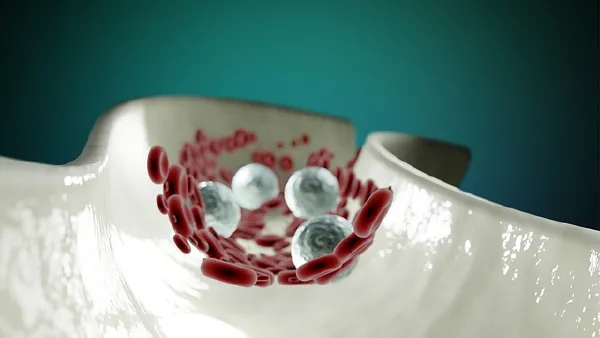 上肢动脉闭塞:一场严重且隐秘的血管战争!