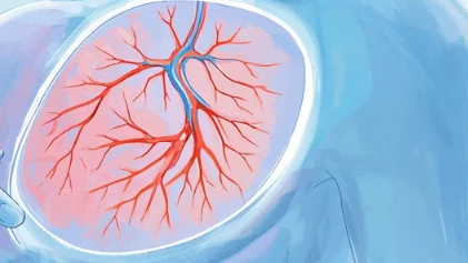 乳腺纤维腺瘤——女性乳腺健康的隐形杀手?