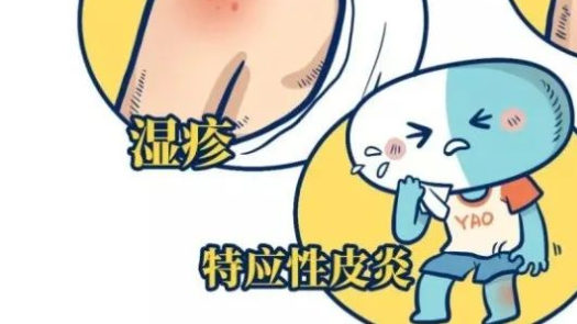 了解湿疹和特应性皮炎：原因、治疗和预防封面图
