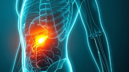 去分化脂肪肉瘤：了解此类恶性肿瘤的关键要点