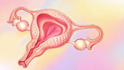 子宫肌瘤与女性健康:你需要知道的一切