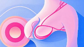乳腺癌的预防与治疗：您需要知道的一切封面图
