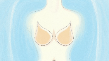 科普，乳腺癌早期信号与预防：女性必知封面图