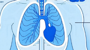 科普，纵隔<span style="color: #da4707">淋巴结</span>肿大的探讨：病因、诊断与治疗