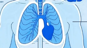 纵隔淋巴结肿大的探讨:病因、诊断与治疗