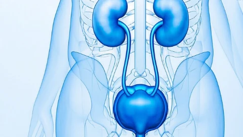 输尿管结石的挑战：伴积水与感染的诊断与治疗策略