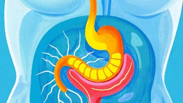 别让阑尾炎静悄悄来袭：早期识别与防治全攻略