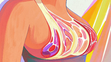科普，打破乳腺癌的阴影：探索ii期her2阳性浸润性导管癌的治疗之路封面图