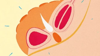 如何与乳腺癌“和平共处”：正确认识与科学应对