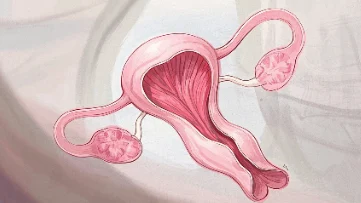 卵巢癌:识别信号,早期科学应对的方法