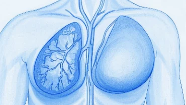 如何科学识别和应对乳腺癌风险?