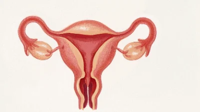 战胜卵巢囊肿——让健康重新拥抱每一个女性!
