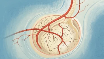 炎性乳腺癌：为何“乳腺炎”可能隐藏“大危险”？