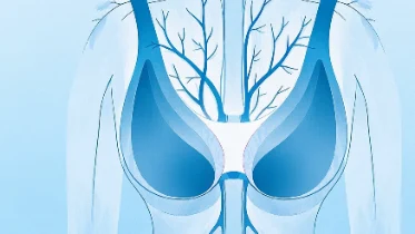 解码乳腺癌病例报告:诊断、治疗与预防全攻略