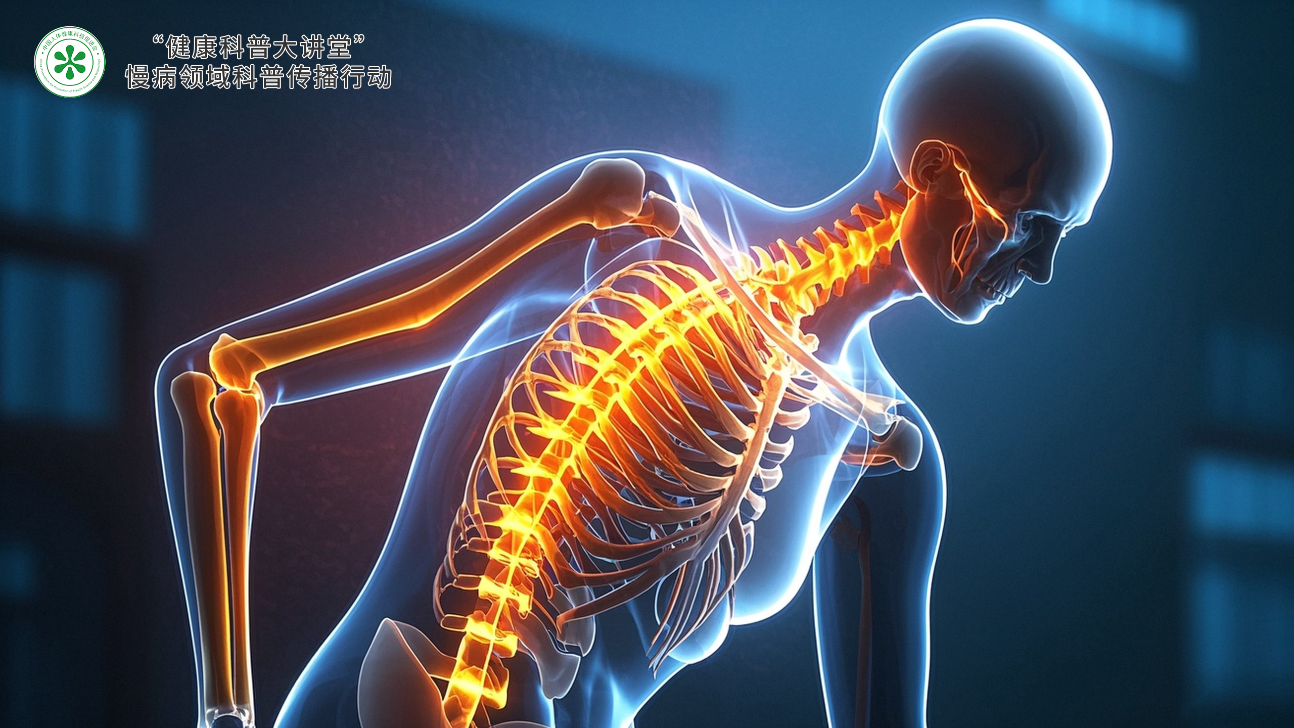 绝经后骨质疏松:风险识别与科学管理