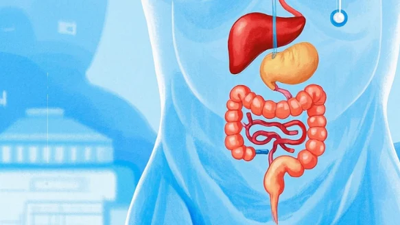 急性肠炎：认识、诊断与管理