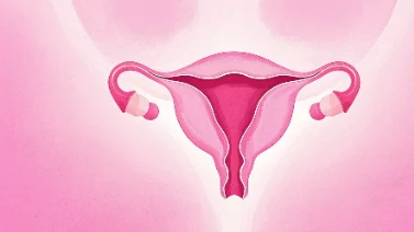 识别卵巢癌信号：女性健康的关键警示