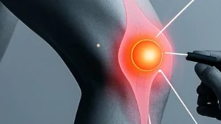 全面解析左膝骨性关节病:病因、诊断与管理