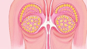 乳腺癌六期：认识疾病、探索治疗与预防途径