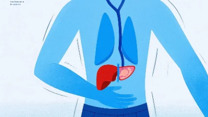 慢性胃肠炎及其伴随症状的科学认知与管理