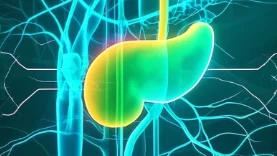 发现胰腺癌:早识症状,科学应对指南