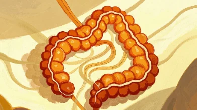 肠癌早期淋巴结转移——肠道健康需重视!