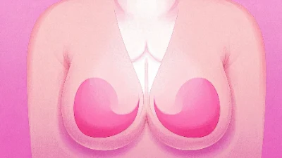 乳腺癌:科学诊断与全程管理