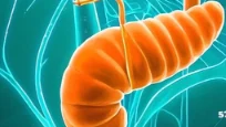 胰腺癌:从诊断到管理的全面解析