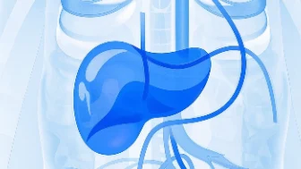 胆囊结石伴急性胆囊炎的综合管理与治疗