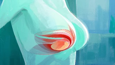 乳腺癌早期信号与科学防控指南