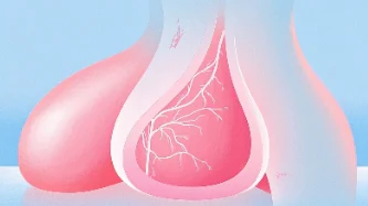 关注乳腺健康:预防和治疗乳腺癌的综合指南