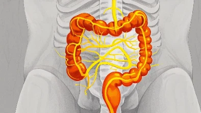 识别结直肠癌：早期信号与预防措施
