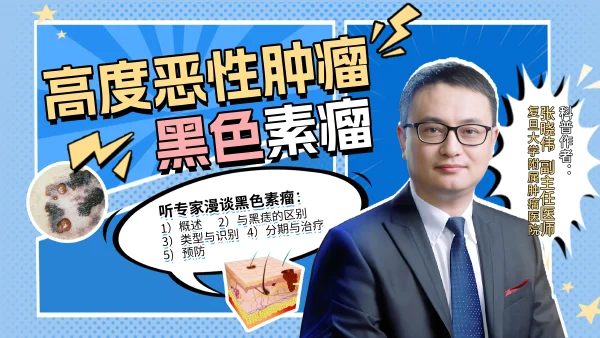 高度恶性肿瘤——黑色素瘤