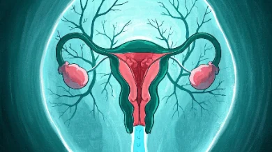 警惕卵巢癌的隐秘信号,女性健康必知!
