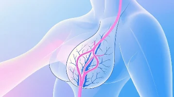 破解“乳腺癌”迷局:从初期到预防,你需要了解的那些事
