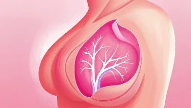乳腺癌,别恐慌!科学防治让你更健康