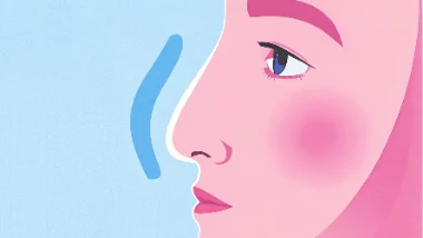 季节性变应性鼻炎:如何应对鼻塞、鼻痒和打喷嚏?