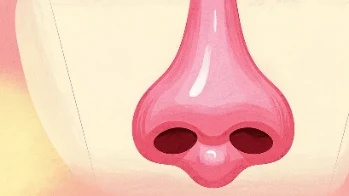 鼻息肉与鼻窦炎：了解症状、成因与治疗策略