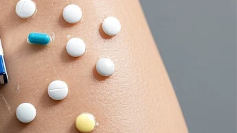 脂溢性皮炎的全面解析：症状、成因、治疗与药物选择