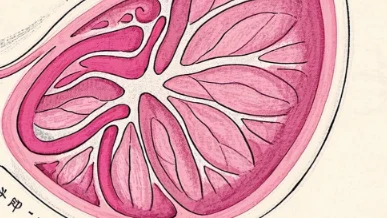 乳腺癌三期:勇敢面对,科学治疗!