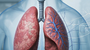 科普,肺恶性肿瘤EGFR L858R突变靶向药物使用全攻略封面图