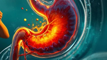 浅析反流性胃炎:诊断与管理