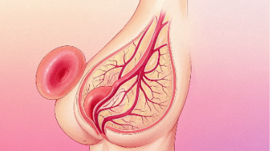 乳腺癌的科学管理与治疗：从诊断到康复的全面解析封面图