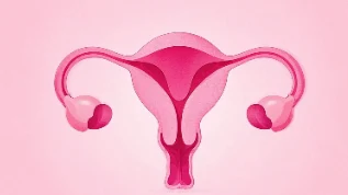 卵巢癌:识别信号,保护女性健康