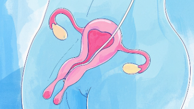 科普，阴道癌：早发现、早治疗，女性健康的守护者封面图